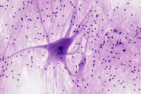 Bild für Seminar Psychoneuroimmunologie als Grundlage der Psychosomatik-